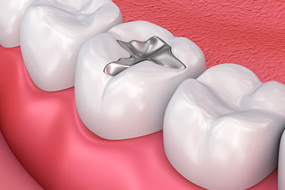 Rossi   DiLeo Dentistry, PC | Pediatric Dentistry, Night Guards and Implant Dentistry
