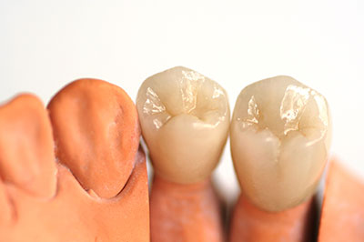 Rossi   DiLeo Dentistry, PC | Emergency Treatment, Periodontal Treatment and Teeth Whitening