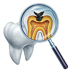 Rossi   DiLeo Dentistry, PC | Veneers, Preventative Program and Periodontal Treatment