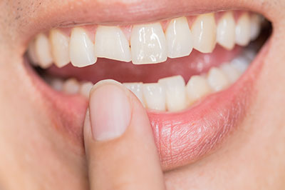 Rossi   DiLeo Dentistry, PC | Botox reg , Veneers and Emergency Treatment