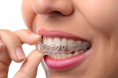 Rossi   DiLeo Dentistry, PC | Extractions, Root Canals and Juvederm reg 