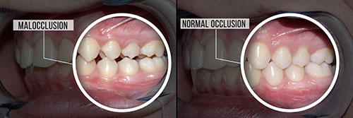Rossi   DiLeo Dentistry, PC | Dental Fillings, Preventative Program and Periodontal Treatment