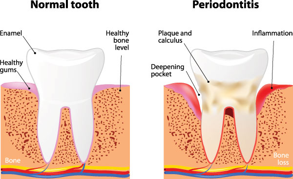 Rossi   DiLeo Dentistry, PC | Implant Dentistry, Digital Radiography and Dentures