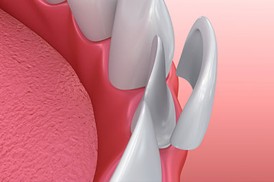 Rossi   DiLeo Dentistry, PC | Botox reg , Intraoral Camera and Implant Dentistry