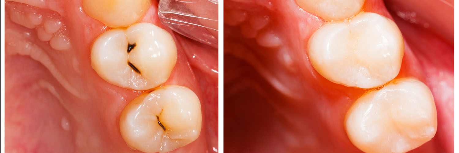 Rossi   DiLeo Dentistry, PC